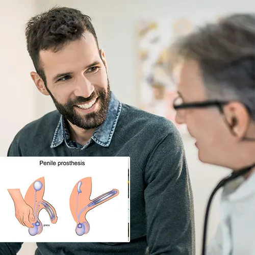 Why Choose  Urology Surgery Center 



for Your Penile Implant Procedure?