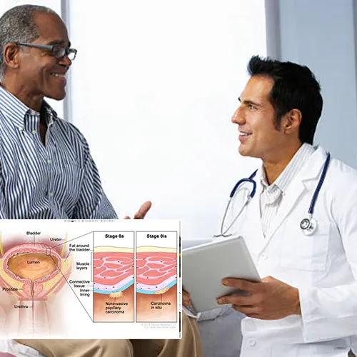 Welcome to  Urology Surgery Center 



: Where Comfort Meets Innovation in Penile Implant Design