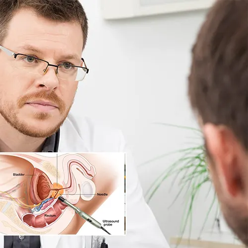 Welcome to  Urology Surgery Center 



: Your Ultimate Guide on Replacing Penile Implants